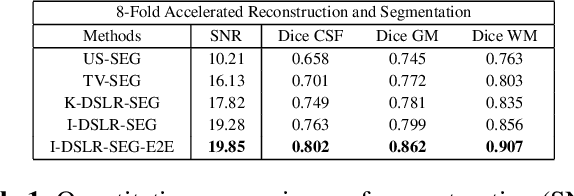 Figure 2 for Reconstruction and Segmentation of Parallel MR Data using Image Domain DEEP-SLR