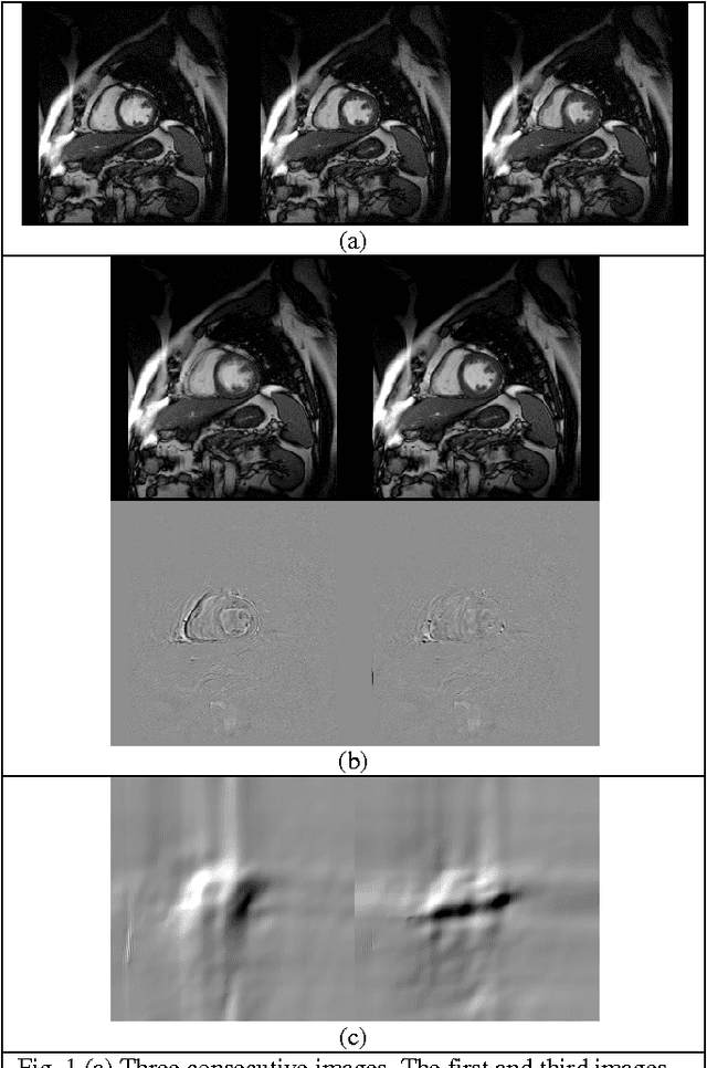 Figure 1 for An Optimization Method For Slice Interpolation Of Medical Images
