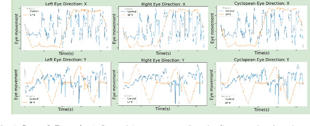 Figure 1 for Virtual-Reality based Vestibular Ocular Motor Screening for Concussion Detection using Machine-Learning