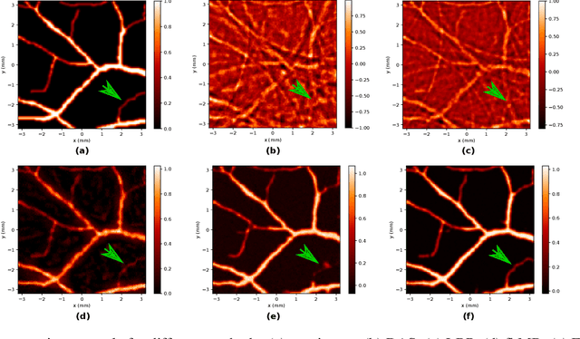 Figure 4 for Combining band-frequency separation and deep neural networks for optoacoustic imaging