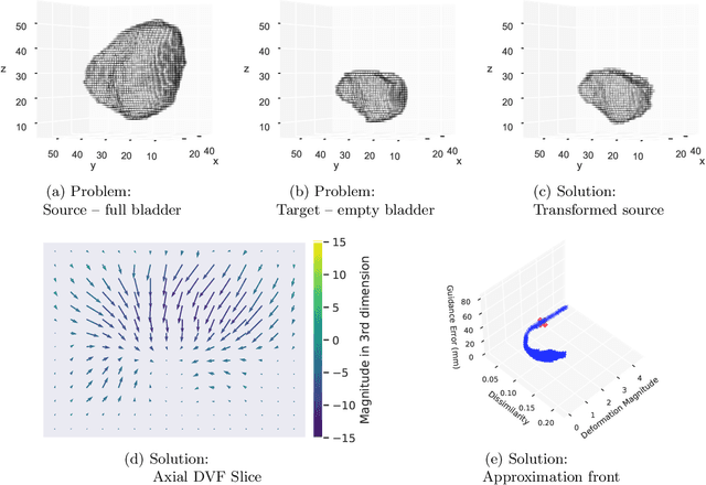 Figure 3 for Multi-Objective Dual Simplex-Mesh Based Deformable Image Registration for 3D Medical Images -- Proof of Concept