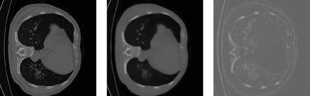Figure 3 for An encoder-decoder-based method for COVID-19 lung infection segmentation