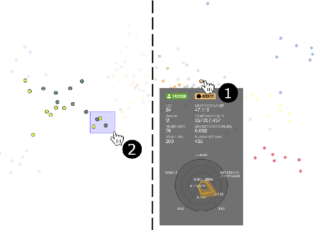 Figure 2 for FiberStars: Visual Comparison of Diffusion Tractography Data between Multiple Subjects