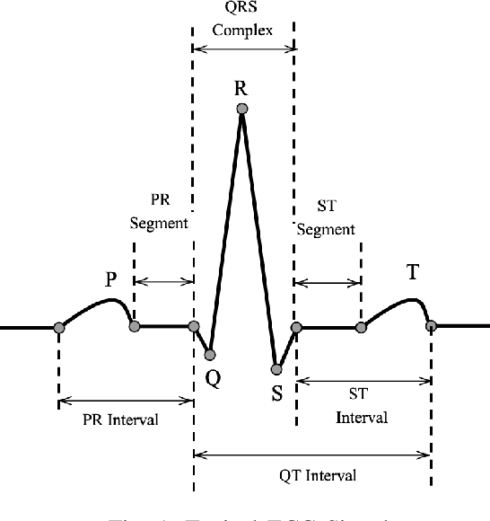 Figure 1 for A Transfer-Learning Based Ensemble Architecture for ECG Signal Classification