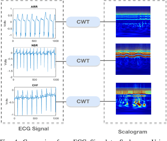 Figure 4 for A Transfer-Learning Based Ensemble Architecture for ECG Signal Classification