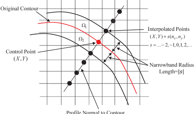 Figure 1 for OCT segmentation: Integrating open parametric contour model of the retinal layers and shape constraint to the Mumford-Shah functional