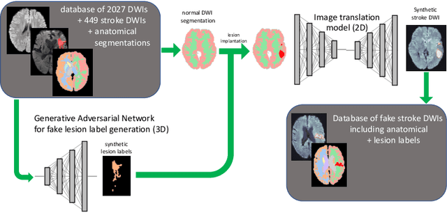 Figure 1 for Image Translation for Medical Image Generation -- Ischemic Stroke Lesions