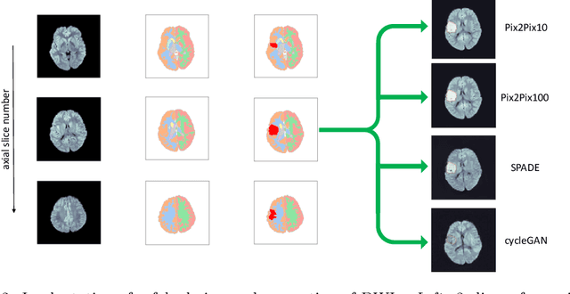 Figure 3 for Image Translation for Medical Image Generation -- Ischemic Stroke Lesions