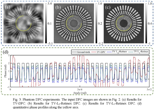 Figure 4 for Retinex-qDPC: automatic background rectified quantitative differential phase contrast imaging