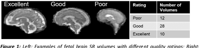 Figure 1 for A comparison of automatic multi-tissue segmentation methods of the human fetal brain using the FeTA Dataset