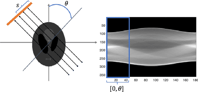 Figure 1 for Limited-angle CT reconstruction via the L1/L2 minimization