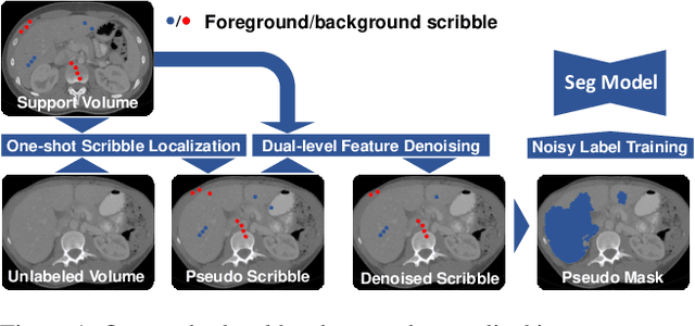 Figure 1 for One-shot Weakly-Supervised Segmentation in Medical Images
