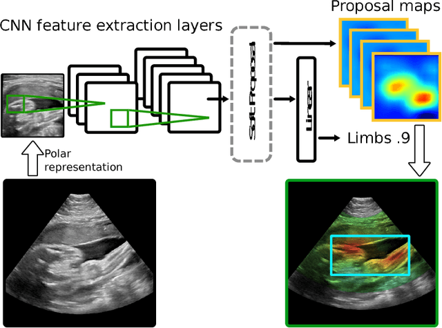 Figure 1 for Weakly Supervised Localisation for Fetal Ultrasound Images