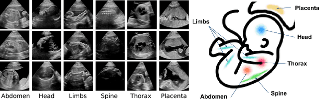 Figure 3 for Weakly Supervised Localisation for Fetal Ultrasound Images
