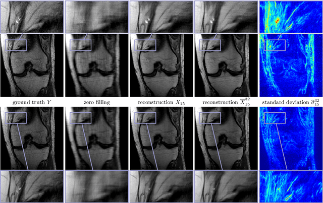 Figure 4 for Bayesian Uncertainty Estimation of Learned Variational MRI Reconstruction