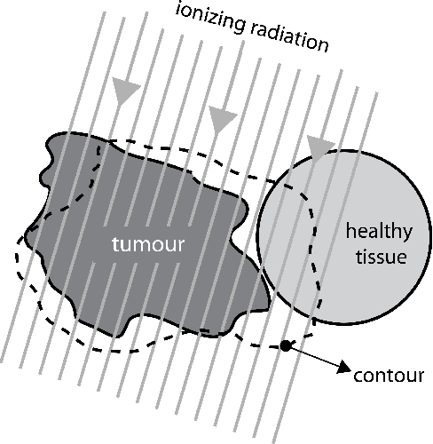 Figure 1 for Fast Barcode Retrieval for Consensus Contouring