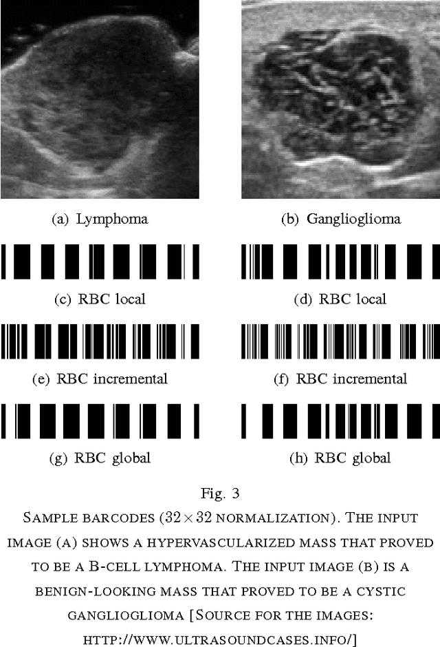 Figure 3 for Fast Barcode Retrieval for Consensus Contouring