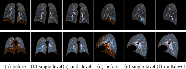 Figure 3 for mlVIRNET: Multilevel Variational Image Registration Network