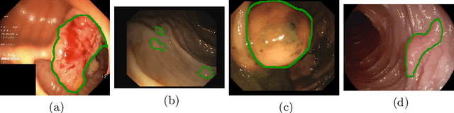 Figure 1 for Double Encoder-Decoder Networks for Gastrointestinal Polyp Segmentation