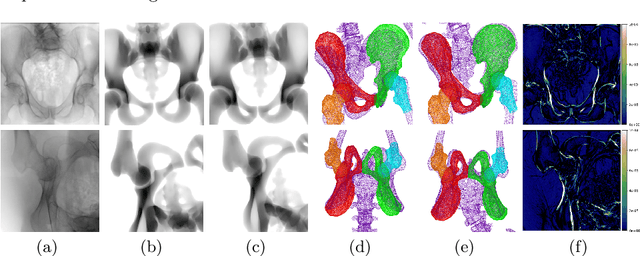 Figure 3 for Deep Learning compatible Differentiable X-ray Projections for Inverse Rendering