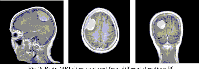 Figure 3 for Segmentation of 2D Brain MR Images