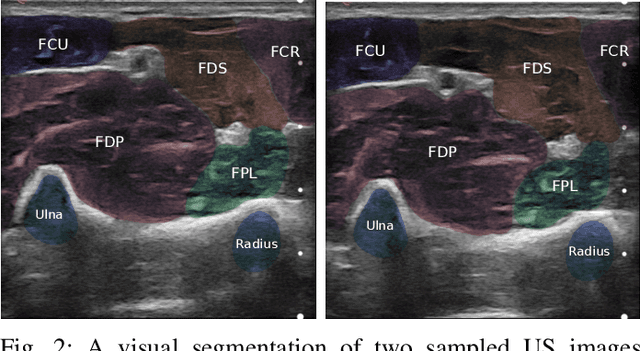 Figure 4 for Towards Predicting Fine Finger Motions from Ultrasound Images via Kinematic Representation