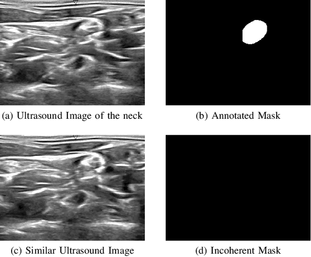 Figure 2 for Hybrid Deep Neural Network for Brachial Plexus Nerve Segmentation in Ultrasound Images
