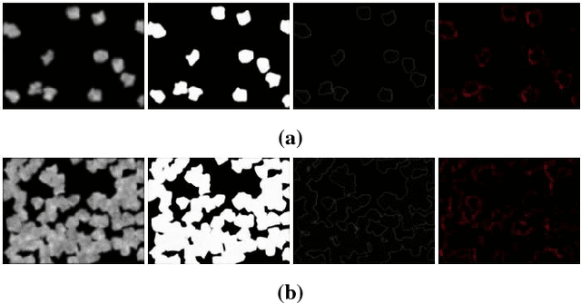 Figure 4 for Using Deep Learning for Segmentation and Counting within Microscopy Data