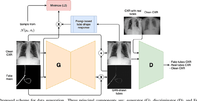 Figure 1 for Tubular Shape Aware Data Generation for Semantic Segmentation in Medical Imaging