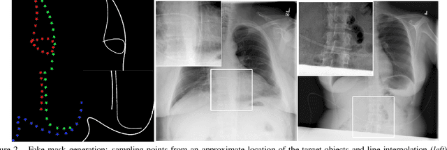 Figure 3 for Tubular Shape Aware Data Generation for Semantic Segmentation in Medical Imaging