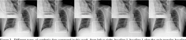 Figure 4 for Tubular Shape Aware Data Generation for Semantic Segmentation in Medical Imaging