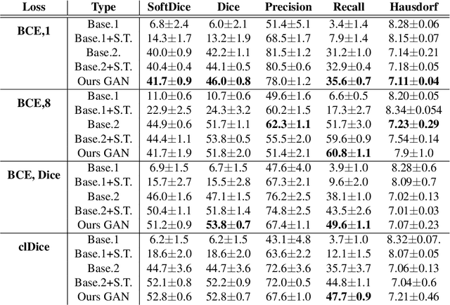 Figure 2 for Tubular Shape Aware Data Generation for Semantic Segmentation in Medical Imaging