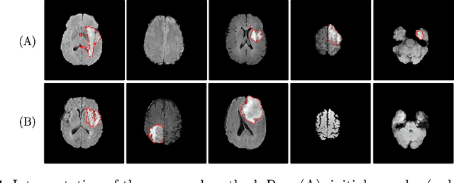 Figure 4 for Suggestive Annotation of Brain Tumour Images with Gradient-guided Sampling