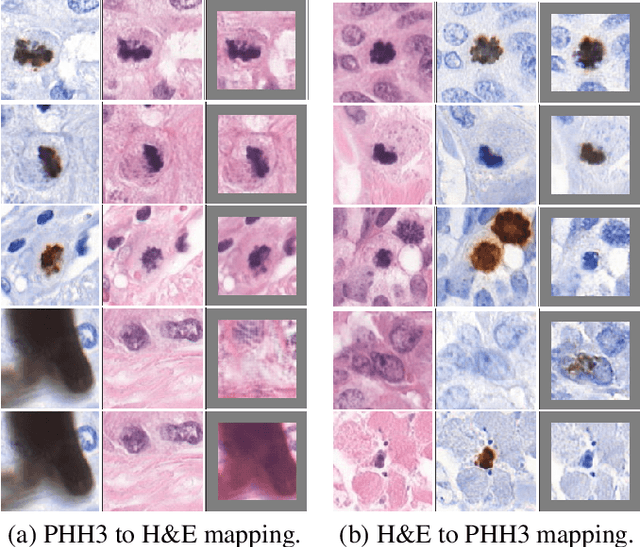Figure 3 for Virtual staining for mitosis detection in Breast Histopathology