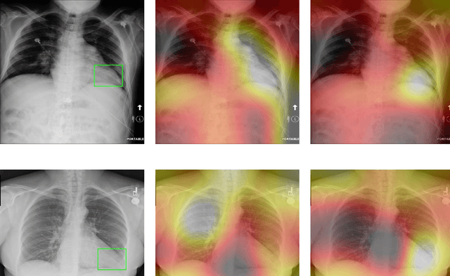 Figure 4 for Mitigating the Effect of Dataset Bias on Training Deep Models for Chest X-rays