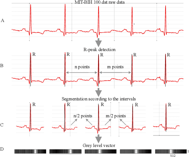 Figure 1 for Multi-Lead ECG Classification via an Information-Based Attention Convolutional Neural Network