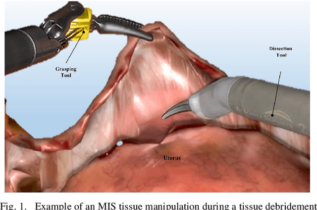 Figure 1 for Toward Synergic Learning for Autonomous Manipulation of Deformable Tissues via Surgical Robots: An Approximate Q-Learning Approach