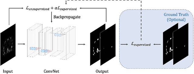 Figure 1 for Learning Fuzzy Clustering for SPECT/CT Segmentation via Convolutional Neural Networks