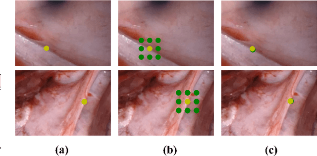 Figure 2 for SMUDLP: Self-Teaching Multi-Frame Unsupervised Endoscopic Depth Estimation with Learnable Patchmatch