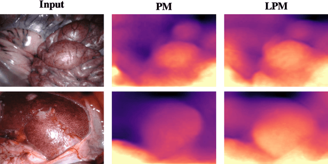 Figure 3 for SMUDLP: Self-Teaching Multi-Frame Unsupervised Endoscopic Depth Estimation with Learnable Patchmatch