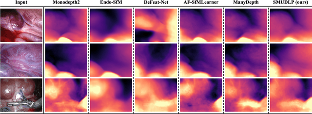 Figure 4 for SMUDLP: Self-Teaching Multi-Frame Unsupervised Endoscopic Depth Estimation with Learnable Patchmatch