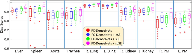 Figure 4 for Recalibrating Fully Convolutional Networks with Spatial and Channel 'Squeeze & Excitation' Blocks