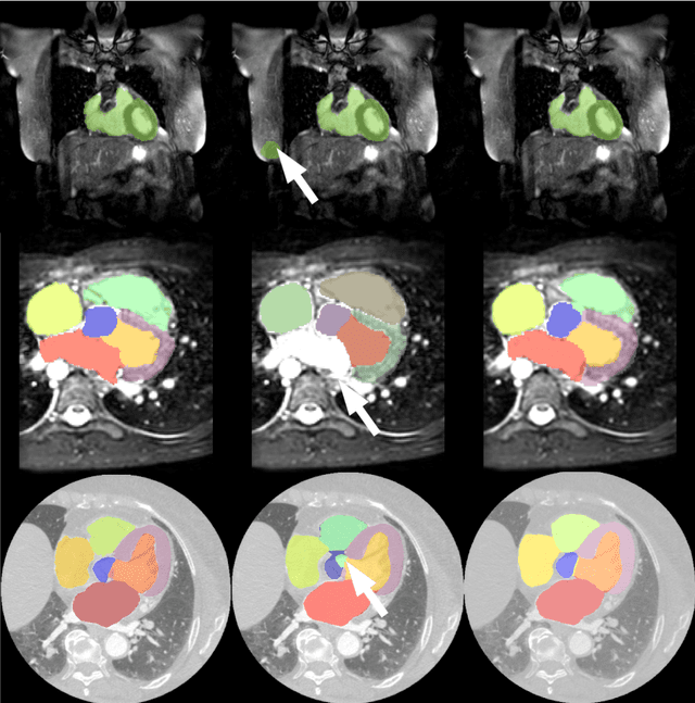 Figure 3 for A two-stage 3D Unet framework for multi-class segmentation on full resolution image