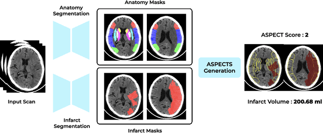 Figure 3 for Deep-ASPECTS: A Segmentation-Assisted Model for Stroke Severity Measurement