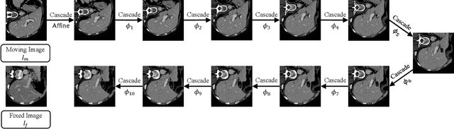 Figure 1 for Recursive Cascaded Networks for Unsupervised Medical Image Registration
