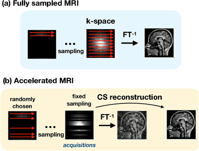 Figure 3 for Self-Supervised Deep Active Accelerated MRI