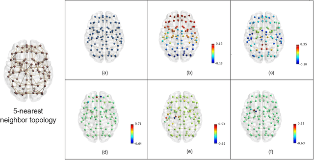 Figure 1 for Combining Anatomical and Functional Networks for Neuropathology Identification: A Case Study on Autism Spectrum Disorder