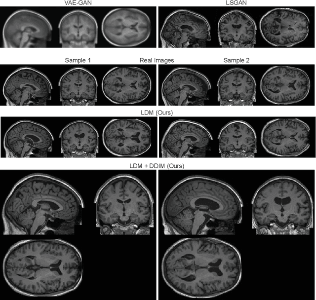 Figure 1 for Brain Imaging Generation with Latent Diffusion Models