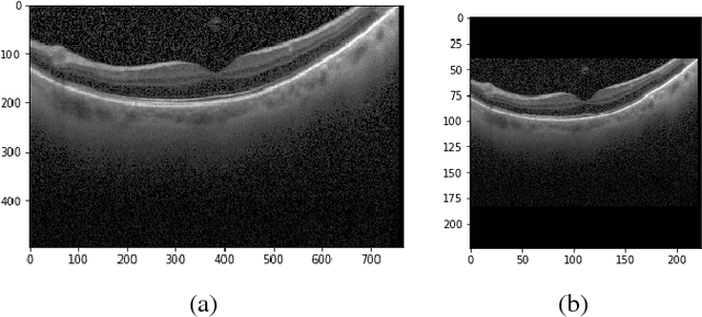 Figure 2 for A Comparison of Handcrafted and Deep Neural Network Feature Extraction for Classifying Optical Coherence Tomography Images