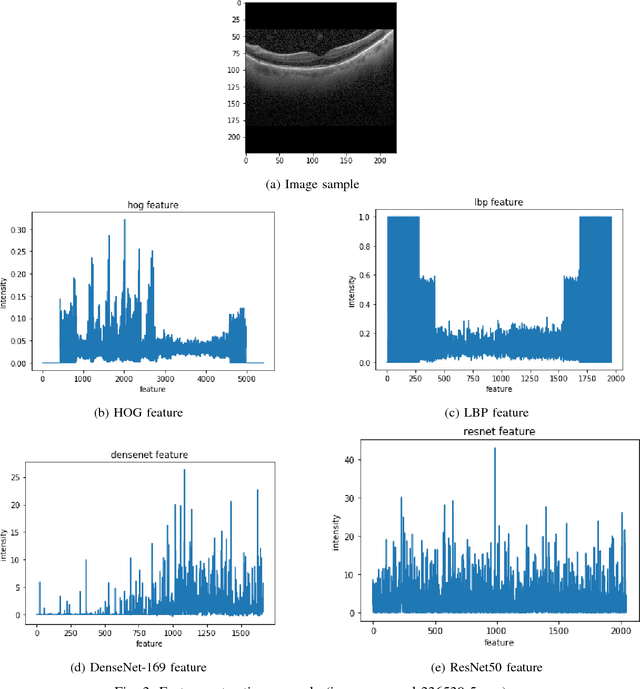Figure 3 for A Comparison of Handcrafted and Deep Neural Network Feature Extraction for Classifying Optical Coherence Tomography Images